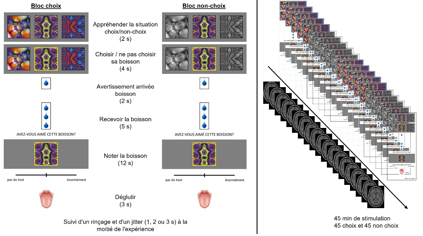 Figure 12. Paradigme pour stimuler le sujet volontaire en situation de Choix et de Non-choix (à gauche) et enregistrement des images 3D du cerveau en parallèle (à droite)